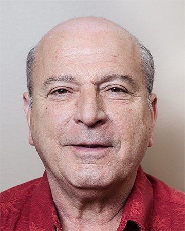 02 mens hair loss solutions before and after 02 solutions before after mens gallery 02 mens hair loss solutions before and after 02
