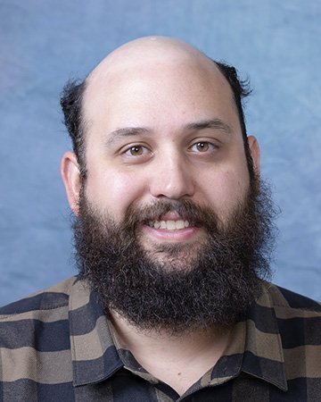03 mens hair loss solutions before and after 02 solutions before after mens gallery 03 mens hair loss solutions before and after 02