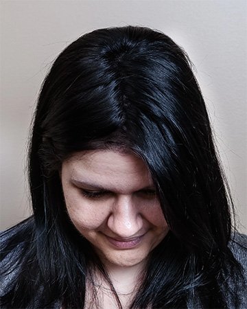   solutions before after womens gallery 01 womens hair loss solutions before and after 01